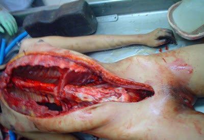 Gambar Mayat Perempuan