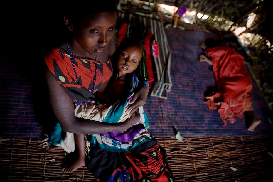 Shangara Hassan con su hija ciega a causa del hambre. Megacampo somalí en Dadaab. Foto: Kate Holt.