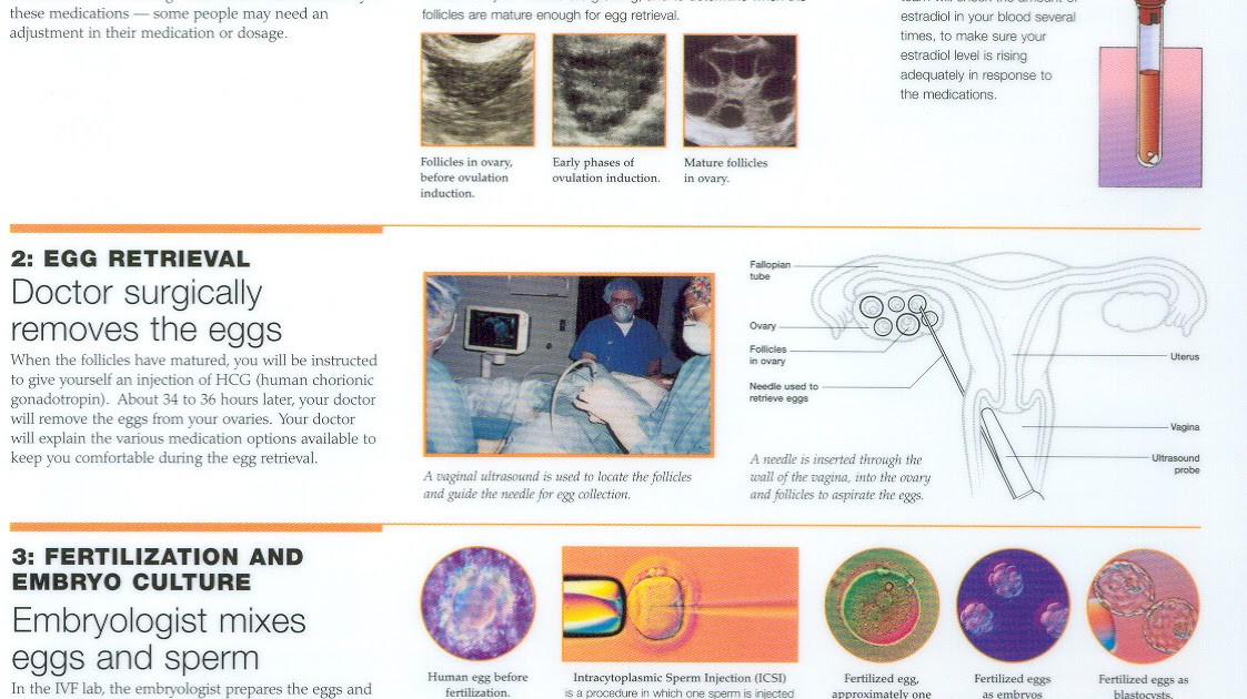 Our Baby Making Journey! So how does IVF work??