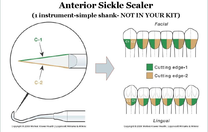 Periodontal Instruments Concepts in periodontal scaling and how tos