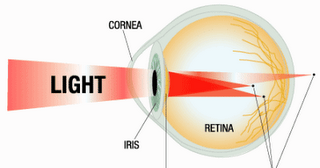Healthy Family 7 Tips To Cure Eye Cylinder