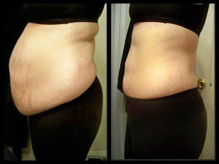 How to take Skinny Fiber