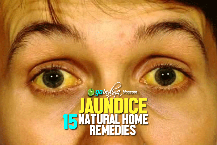 jaundice natural remedies essay We will write a custom essay sample on natural habitat specifically for you for only $1638 $139/page order now jaundice natural remedies send me this sample. jaundice natural remedies essay We will write a custom essay sample on natural habitat specifically for you for only $1638 $139/page order now jaundice natural remedies send me this sample.