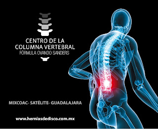 El complejo completo de los ejercicios para el tratamiento de la columna vertebral