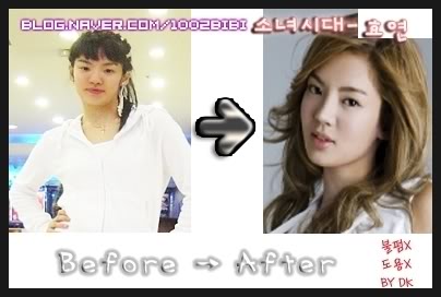 SONE'S Blog: SNSD Plastic Surgery