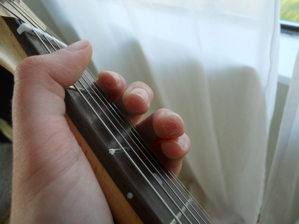 fingers hurt from playing guitar