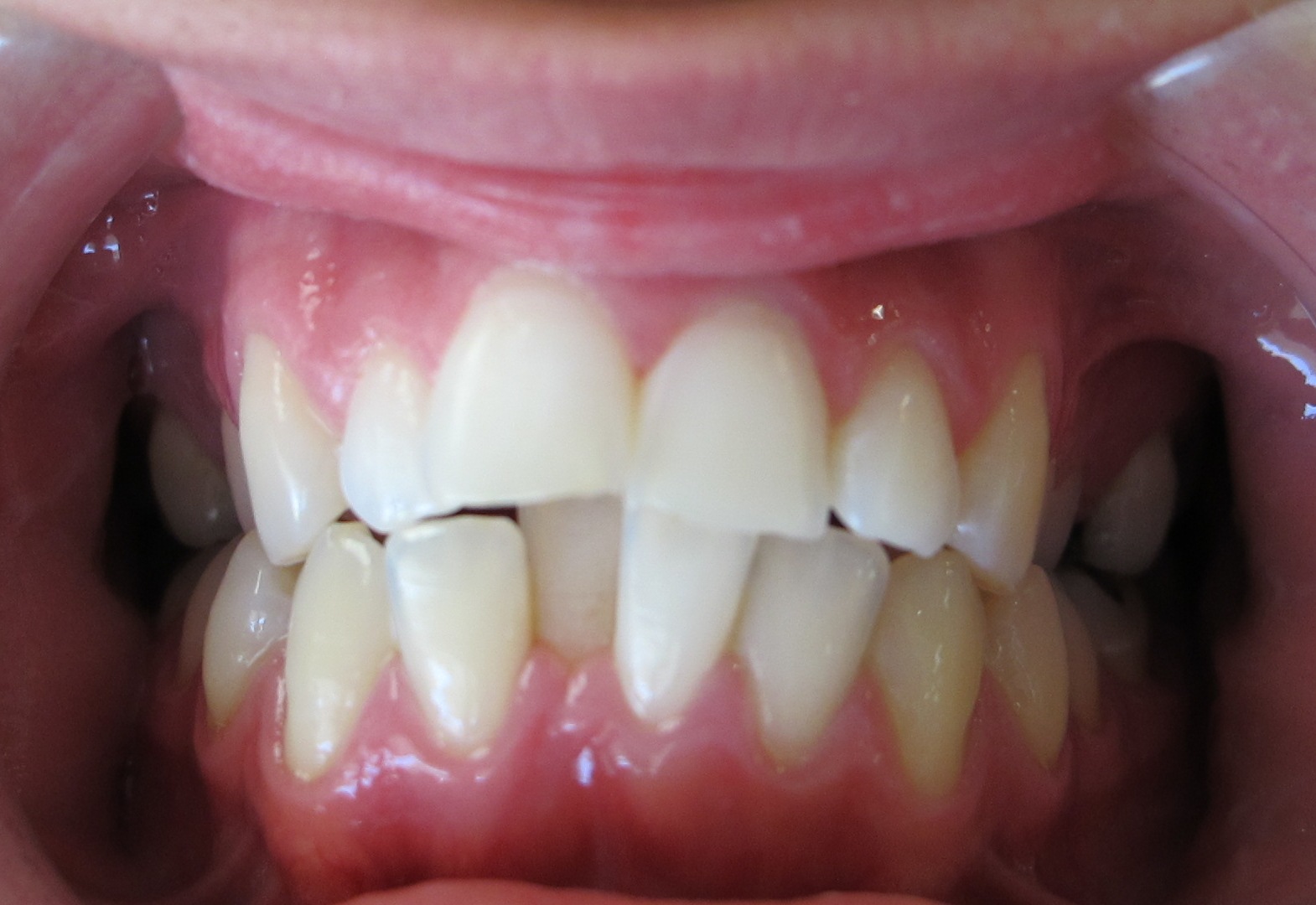 Boschken Orthodontics1570 x 1080