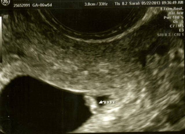 We share our journey to have another baby and the trials, heartache, sadness and loss we've gone through. This is Part 2 in my Finding Out series. #babies #family #loss We share our journey to have another baby and the trials, heartache, sadness and loss we've gone through. This is Part 2 in my Finding Out series. #babies #family #loss