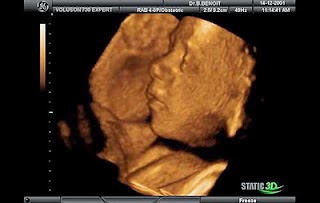 kadinkadina gebelikte 31 hafta neler oluyor hamilelik