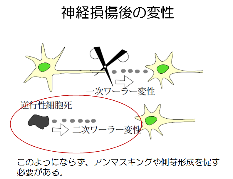 脳卒中リハビリのお勉強 ニューロリハビリテーション(神経可塑性のメカニズム)その①