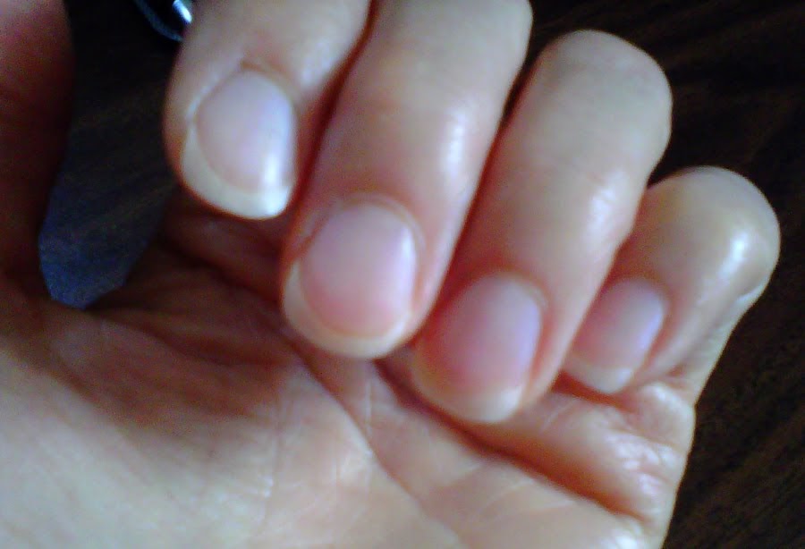 Fingernails week window digest july them detox daily health The Daily Detox: Your Fingernails are a Window to Your Health