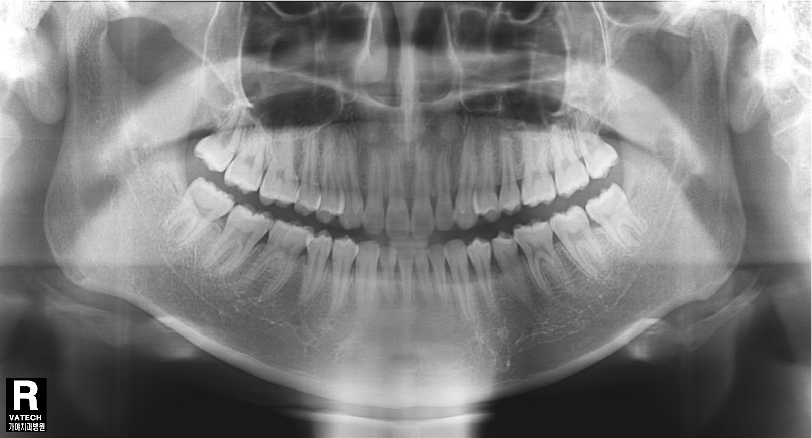 ohikendoit. Dental Radiography.