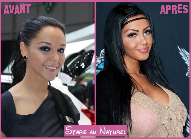 stars au naturel nabilla benattia et la chirurgie esthetique