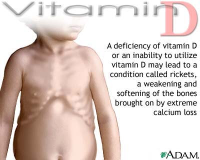 Current practice may over-diagnose vitamin D deficiency