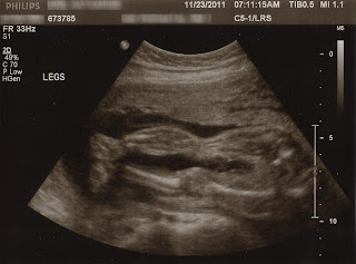 24 week ultrasound