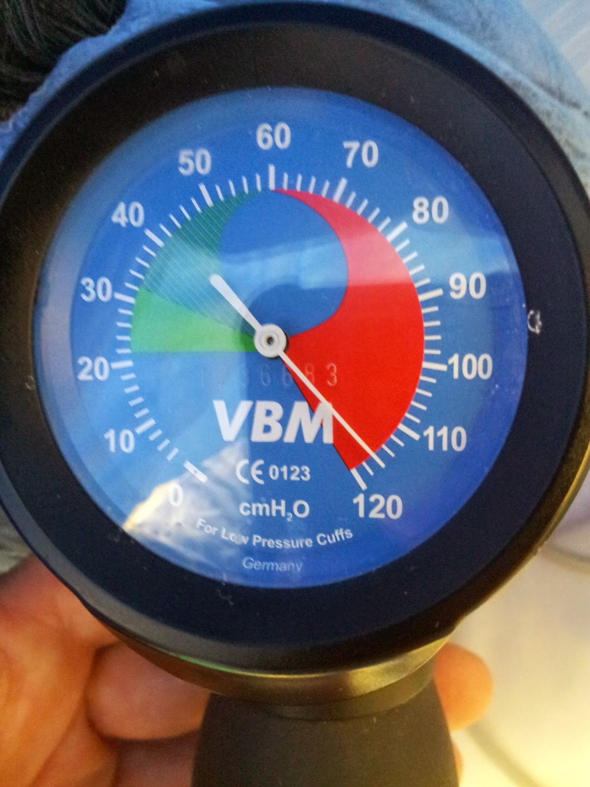 Loveurtrachea, a CRNA Blog