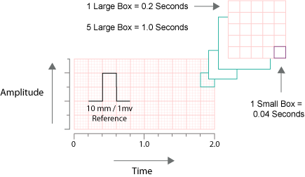 ecg electocardiogram 12 leads ecg med club ecg graph paper scale