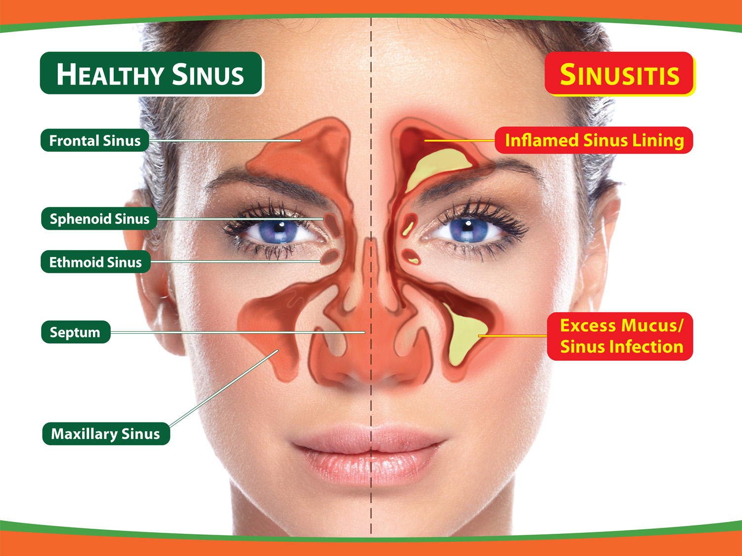Nose Sinus