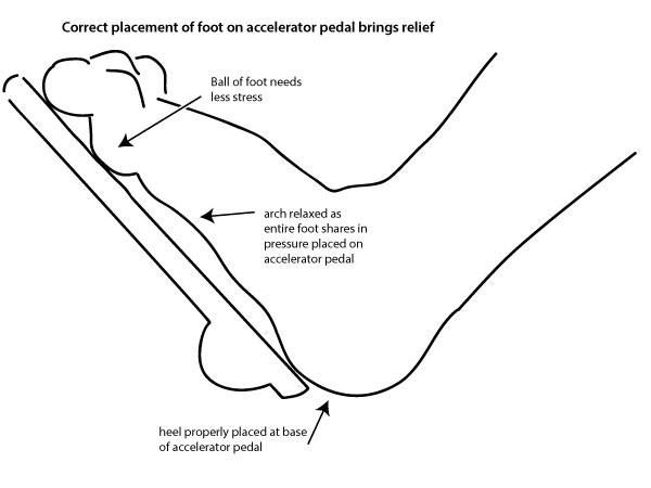 Tim Fink Blog: Fink Scientific(TM): Pedal Pain Explained and Conquered