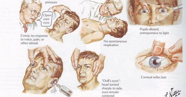 Brain Jack Image: Brain Death