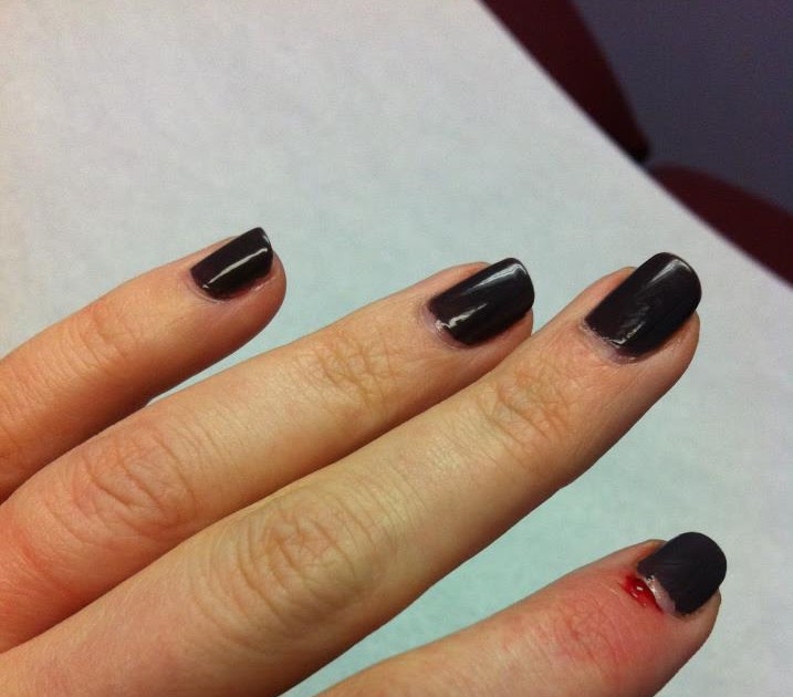 Werdyab Blog A Blogging Injury