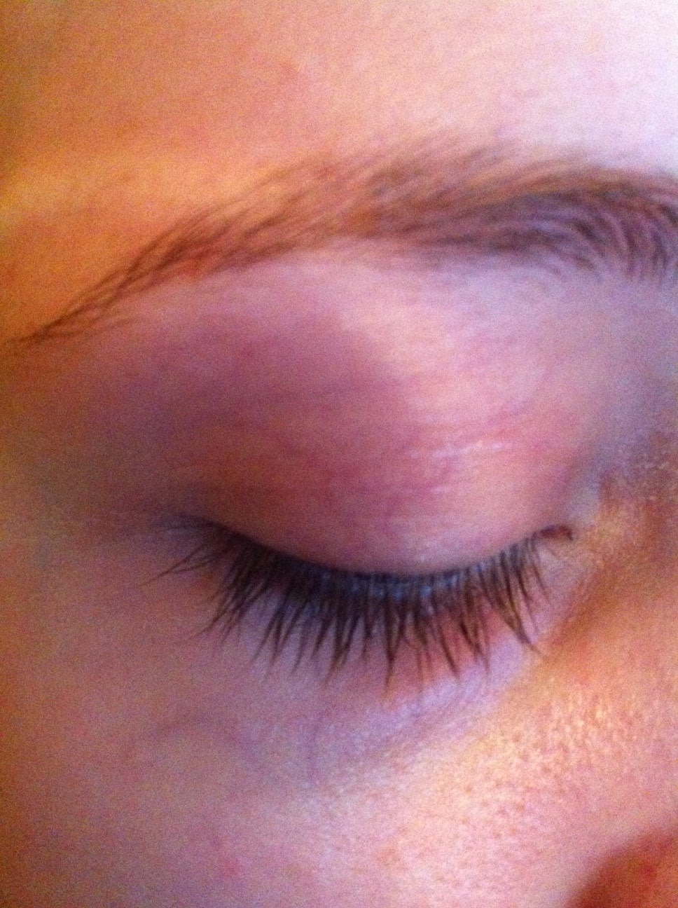 eye under veins rid eyes bags much