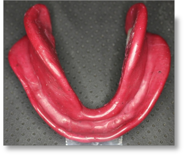 Step by step Guide for Understanding the Prosthodontics Complete