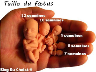 Avortement foetus 12 semaines