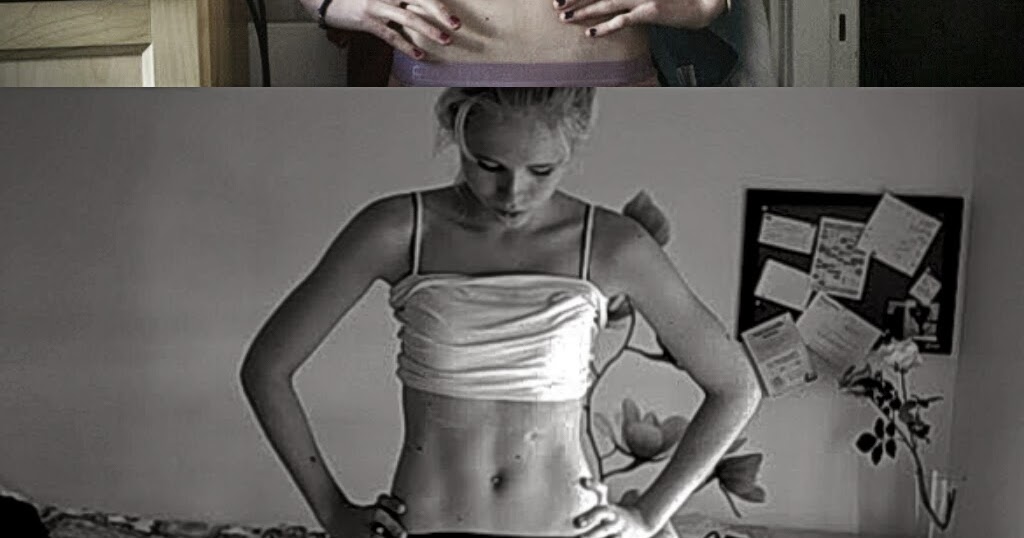 Anorexic inna fan image