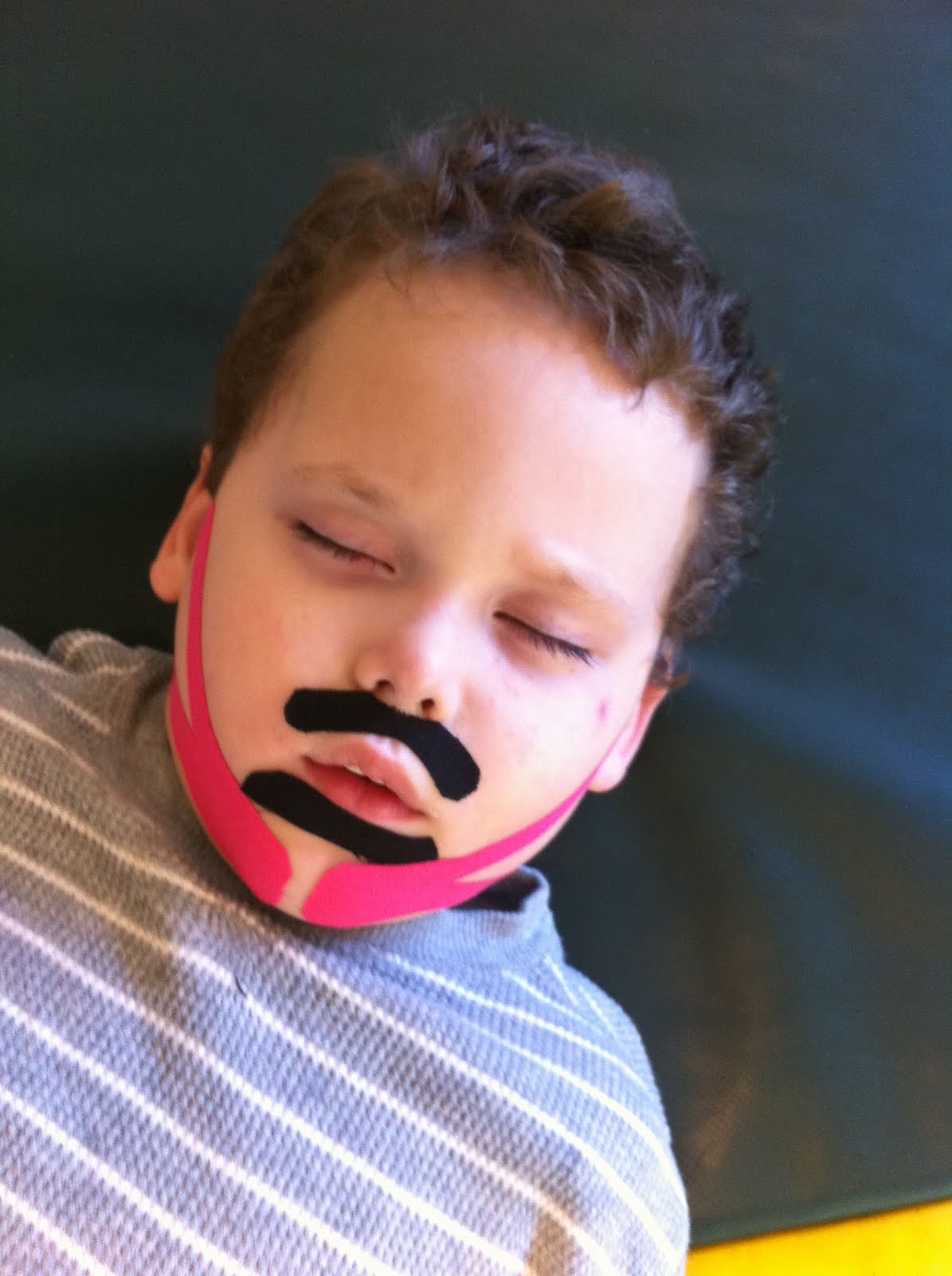 Movement Disorder Part Boy. Part (Kinesio) Tape.