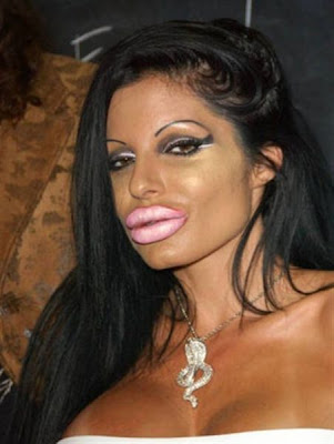 Plastic Surgery  Wrong Photos on Plastic Surgery Gone Wrong   Damn Cool Pictures