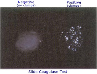 coagulase test clumping positive procedure principle negative tests interpretation drop biochemical