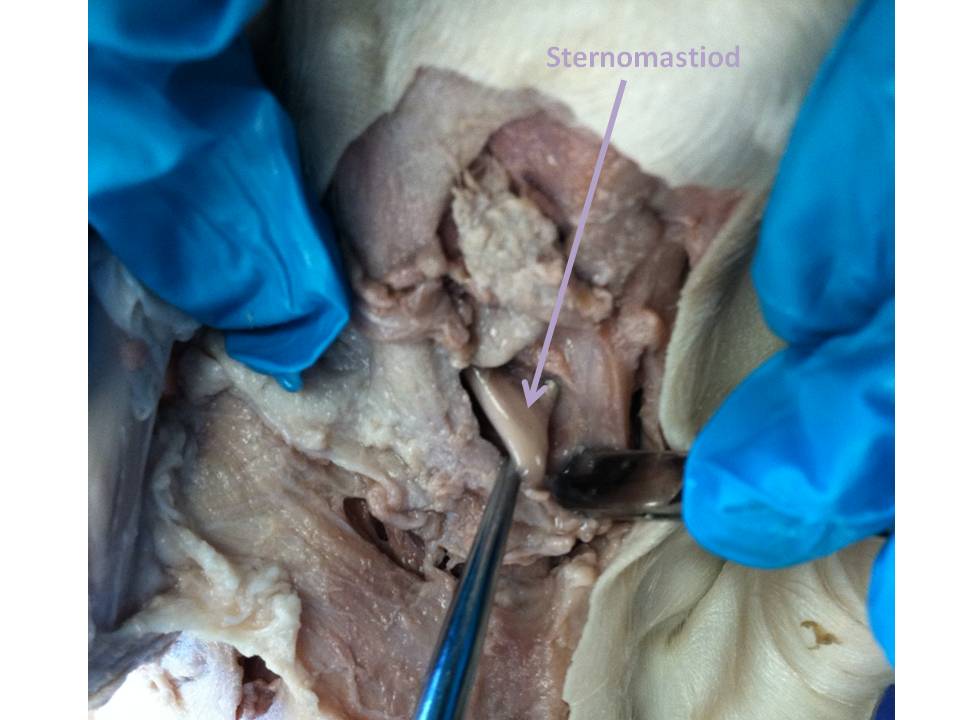 Adventures with Stanley: Step 3: Isolating Cheek and Neck/Throat Muscles