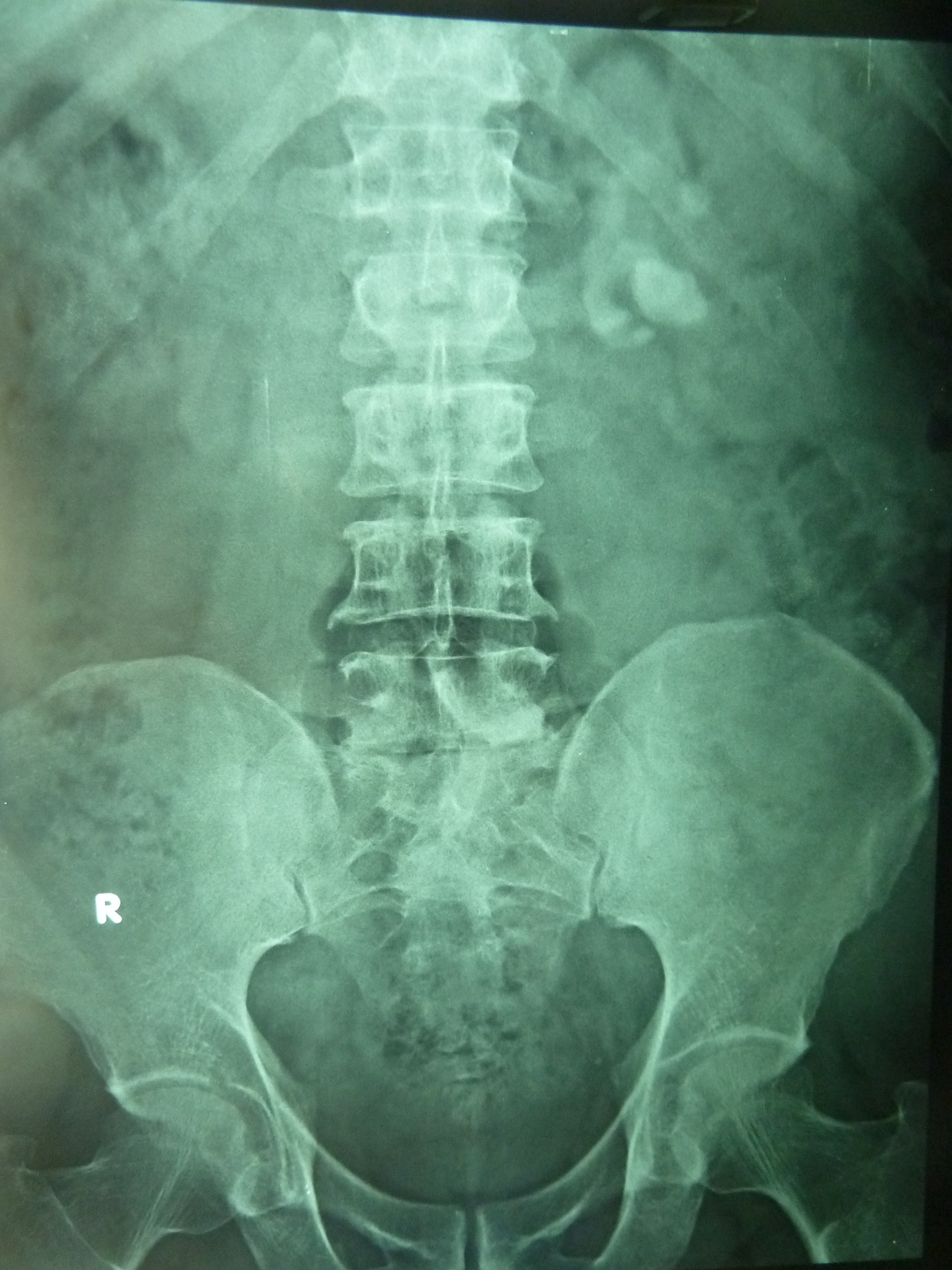 Ramayya Pramila Urology Hospital January 2012