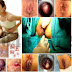 Cara Mengobati Agar Wasir (Hemoroid) Cepat Kempes thumbnail