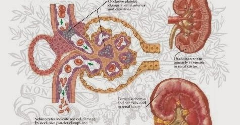 uremic