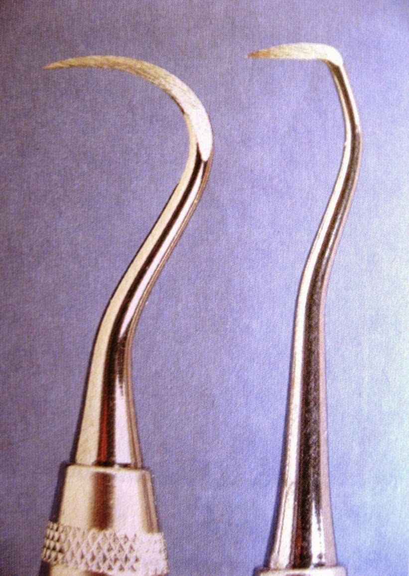 sickle scaler sickle scaler