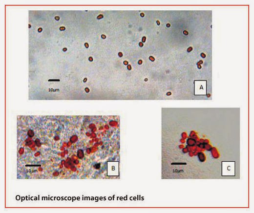 Optical microscope image of red cells of kerala red rain