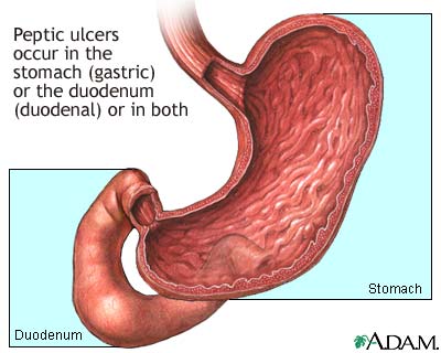 8 home remedies for stomach aches