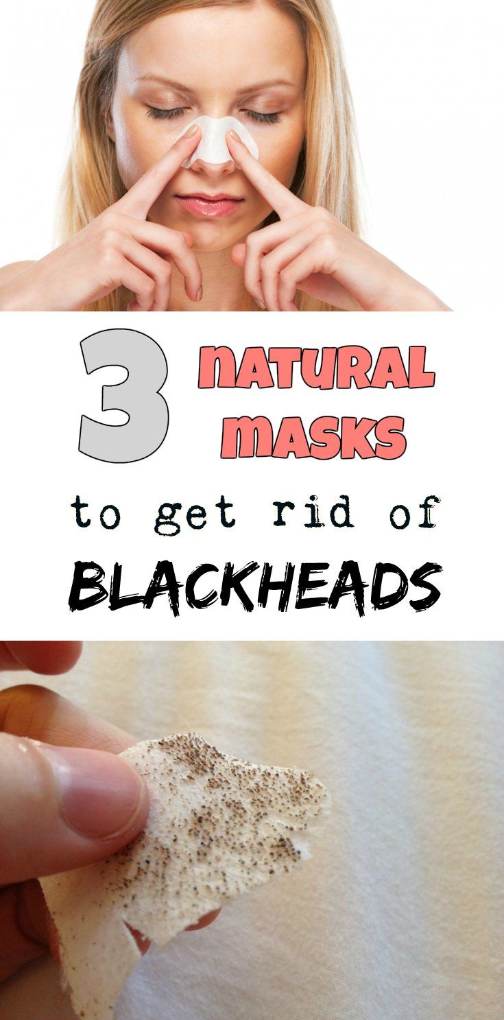 3 Natural Masks to Get Rid of Blackheads Health, Fitness, Beauty Remedies