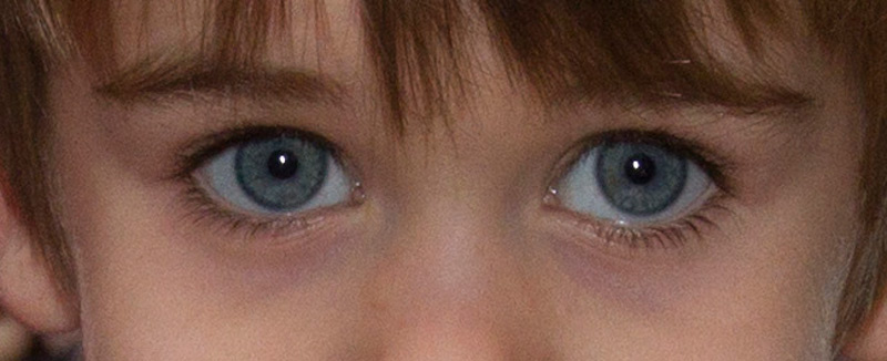Que aceite cosmético es mejor para la piel alrededor de los ojos