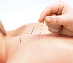 Acupunctura reduce repercusiunile stresului