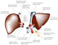 LIVER TRANSPLANTATION LIVER TRANSPLANTATION