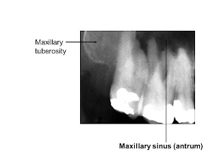 Slide38.JPG