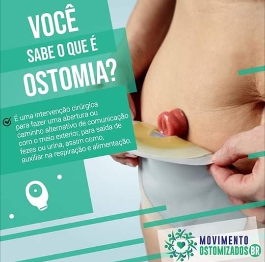 Você Sabe o que é ostomia ?