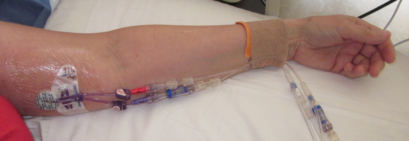 picc line care