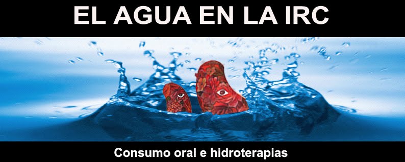 Agua en la IRC