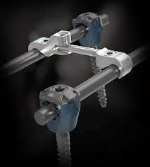 Pedfuse www.thespinemarketgroup.com