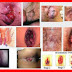 Obat Manjur Atasi Berak Di Sertai Darah thumbnail