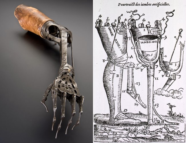To Infinity And...In Theory From Peg Legs to Exoskeletons Prosthetic